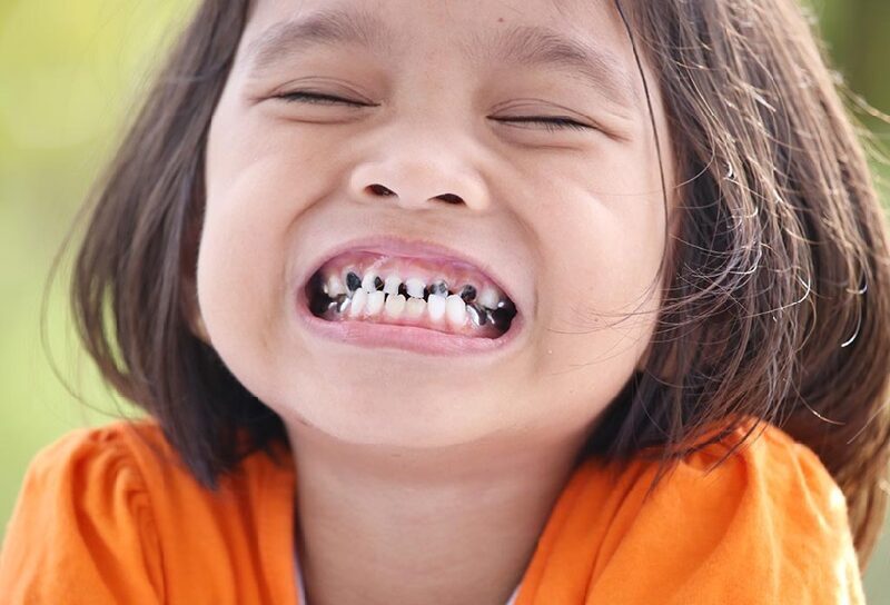 khó chịu do mọc răng