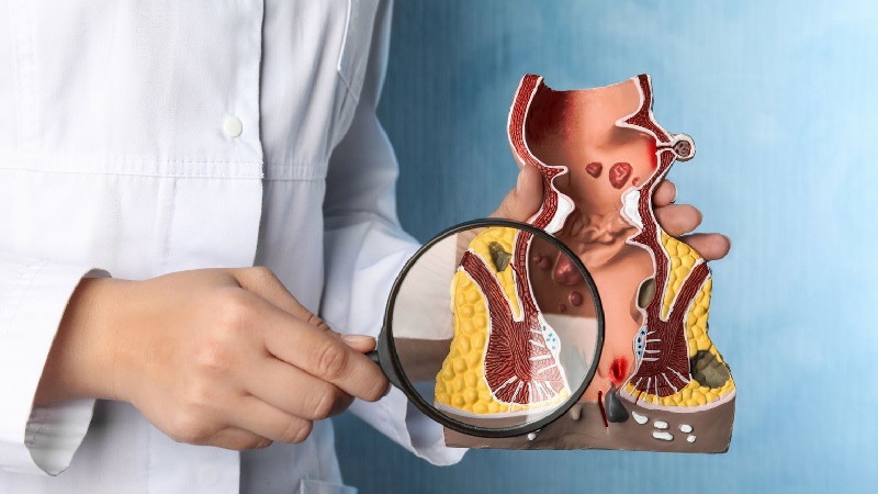 Vì sao trẻ mới ăn dặm dễ bị táo bón